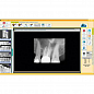 FONA CDR powered by SCHICK - система компьютерной стоматологической радиографии | FONA Dental s.r.o. (Словакия)